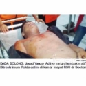 Dorr<i>!</i> Di Dada Begal Ini Ditemukan Tato Bertuliskan 'Rampok'