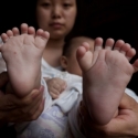 Hong Hong Lahir Dengan 31 Jari Tangan Dan Kaki