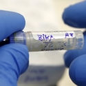 Zika Menyebar, Permintaan Aborsi Melonjak