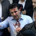 Parlemen Dilempari Batu Setelah Etnis Albania Jadi Pembicara
