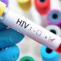 Diagnosa HIV Di Eropa Timur Mengkhawatirkan