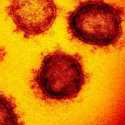Pakar Universitas Oxford: Virus Corona Sudah Lama Eksis Di Berbagai Tempat, Namun 'Tidak Aktif'