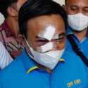 Polisi Sudah Tangkap Terduga Pengeroyok Ketum KNPI Haris Pertama