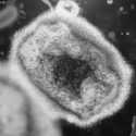 WHO: Eropa dan Amerika Negara Terbanyak yang Terinfeksi Monkeypox