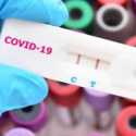 Lebih Unggul dari Vaksin, Kekebalan Alami Covid-19 Bisa Bertahan 14 Bulan
