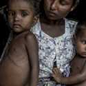 WHO: 39 Persen Masyarakat Sudan Diperkirakan Alami Malnutrisi dalam Enam Bulan Mendatang