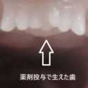 Perusahaan Farmasi Jepang Kembangkan Obat Penumbuh Gigi