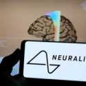 Pasien Pertama Implan Otak Neuralink Bisa Gerakkan Kursor Komputer dengan Kekuatan Pikiran