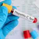 10 Juta Penderita Hepatitis C, Krisis Lain Sektor Kesehatan Pakistan