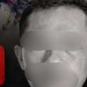 Polisi Usut Kematian Sutrimo, Diduga Karumga Mantan Jampidsus Febrie Adriansyah