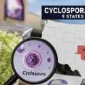 Wabah Cyclosporiasis Meluas di AS, Hampir 2.000 Orang Terinfeksi