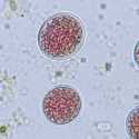 Wabah Cyclosporiasis di AS Renggut Dua Nyawa, Lebih dari 18 Ribu Terinfeksi