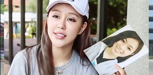Operasi Plastik 30 Kali Demi Mirip Bintang Porno Favorit Pacarnya, <i>YouTuber</i> Ini Menyesal
