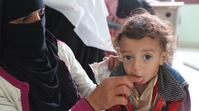 Konflik Tak Kunjung Usai, Jutaan Anak Di Yaman Beresiko Kelaparan
