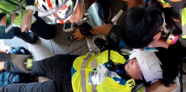 Begini Kronologi Penembakan Wartawan Indonesia Di Tengah Unjuk Rasa Di Hong Kong