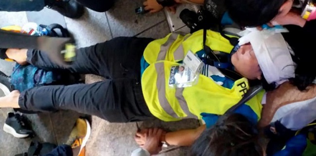 Ditembak Polisi Hong Kong, Wartawan Indonesia Buta Permanen
