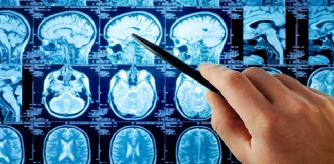Dapatkah Terapi Otak Membantu Penyembuhan Pasien Covid-19?