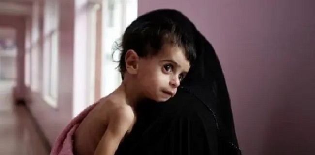 Dana Kemanusiaan PBB Menipis, Anak-anak Di Yaman Makin Terancam Kekurangan Gizi
