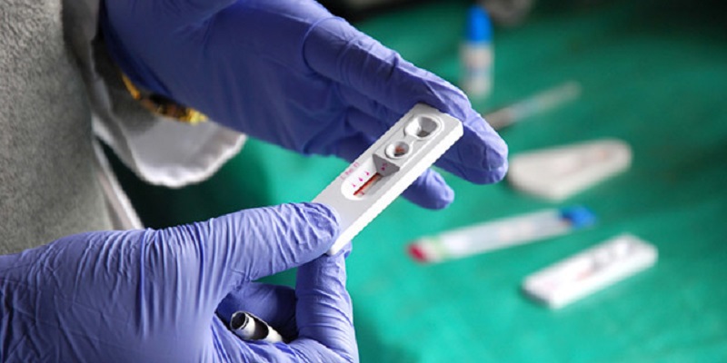 Muncul Hasil Tes HIV Positif Palsu, Pengembangan Vaksin Universitas Queensland Dihentikan