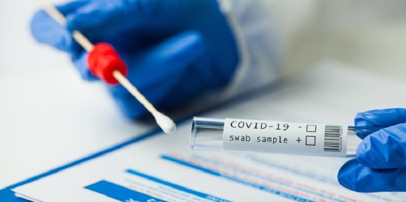 China Sudah Borong Tes PCR Covid-19 Sebelum Kasus Pertama Resmi Dilaporkan
