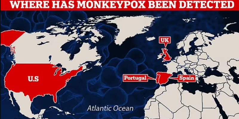 AS Deteksi Kasus Pertama Cacar Monyet yang Menyebar di Eropa