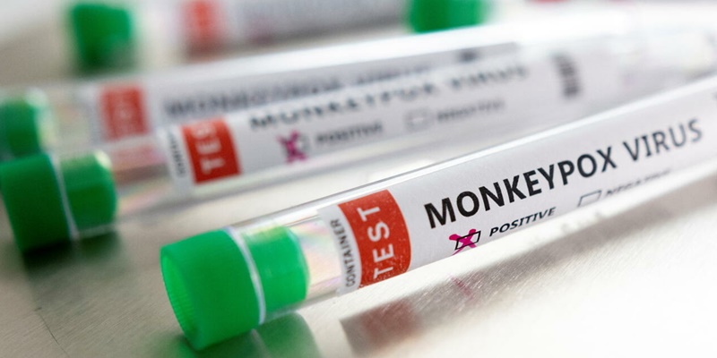 Ahli Virologi Thailand Waspada, Kasus Monkeypox Bisa Meroket karena Perbatasan Dibuka
