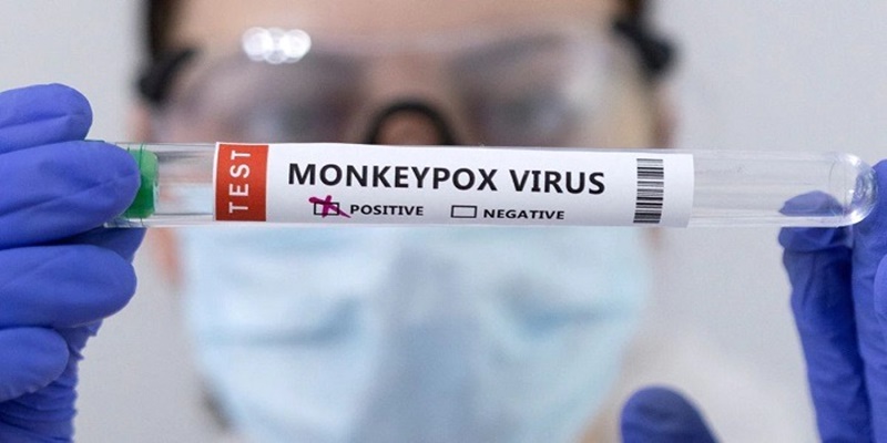 Monkeypox Catat Kematian Pertama di Luar Afrika