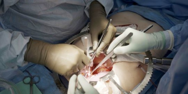 Transplantasi Ginjal Babi pada Manusia Catat Rekor 32 Hari
