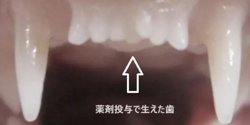 Perusahaan Farmasi Jepang Kembangkan Obat Penumbuh Gigi
