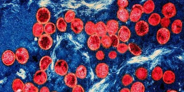 WHO Khawatir, Sebaran Penyakit Mpox di Republik Kongo Terus Melonjak