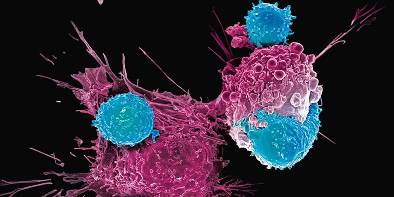 Metode Baru Ini Diklaim Mampu Hancurkan Sel Kanker hingga 99 Persen