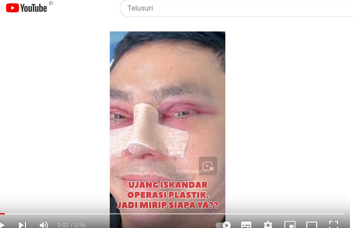 Anggota DPR Ujang Iskandar Operasi Wajah Sebelum Dicokok Tim Tangkap Buronan