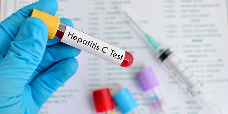 10 Juta Penderita Hepatitis C, Krisis Lain Sektor Kesehatan Pakistan