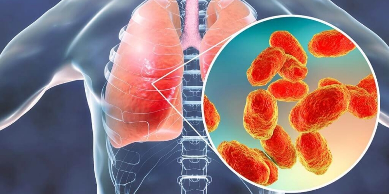 Waspada Pneumonia, Ini Imbauan Kemenkes