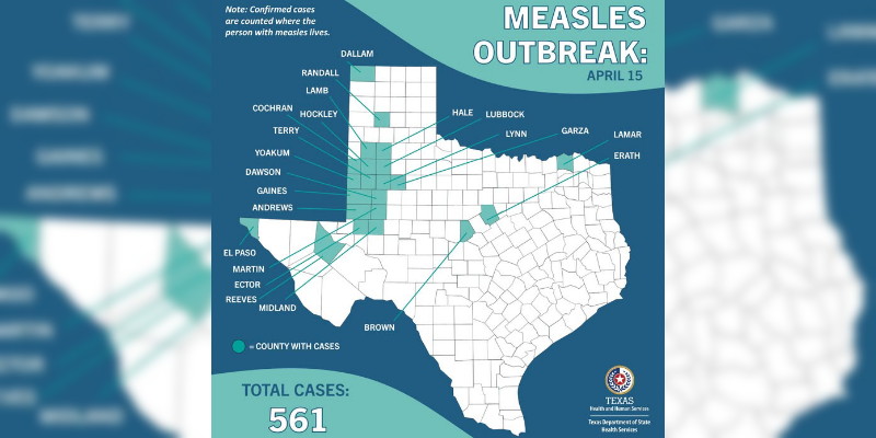 Wabah Campak di Texas Mengkhawatirkan, Tembus 561 Kasus