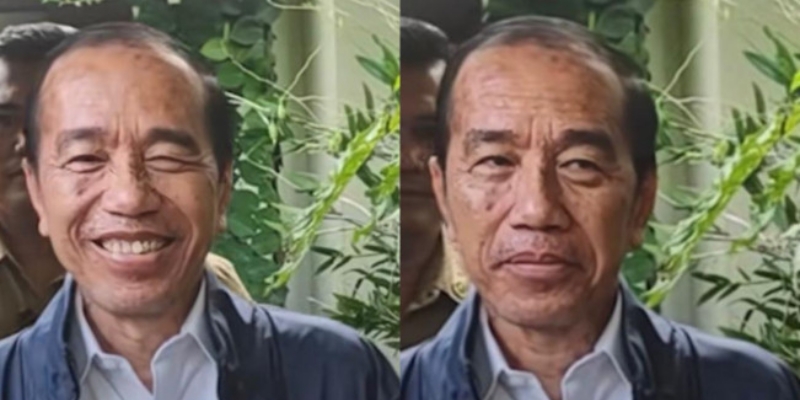 Dokter Tifa Doakan Sakit Kulit Jokowi Cepat Sembuh