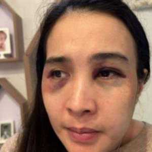 Saling Lapor, Akhirnya Polisi Tetapkan Pasutri di Depok Sebagai Tersangka