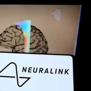 Ternyata Neuralink Sudah Tahu Sejak Lama Kabel Implan Otak akan Bermasalah