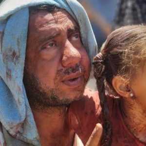 UNRWA: Bau Darah Memenuhi RS Gaza Setelah Pembantaian Israel