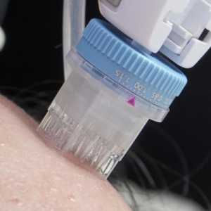 Immoderma Clinic Hadirkan Remee Pro, Teknologi Baru Injector Skinbooster
