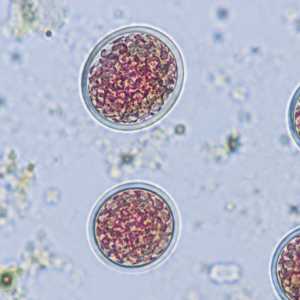 Wabah Cyclosporiasis di AS Renggut Dua Nyawa, Lebih dari 18 Ribu Terinfeksi